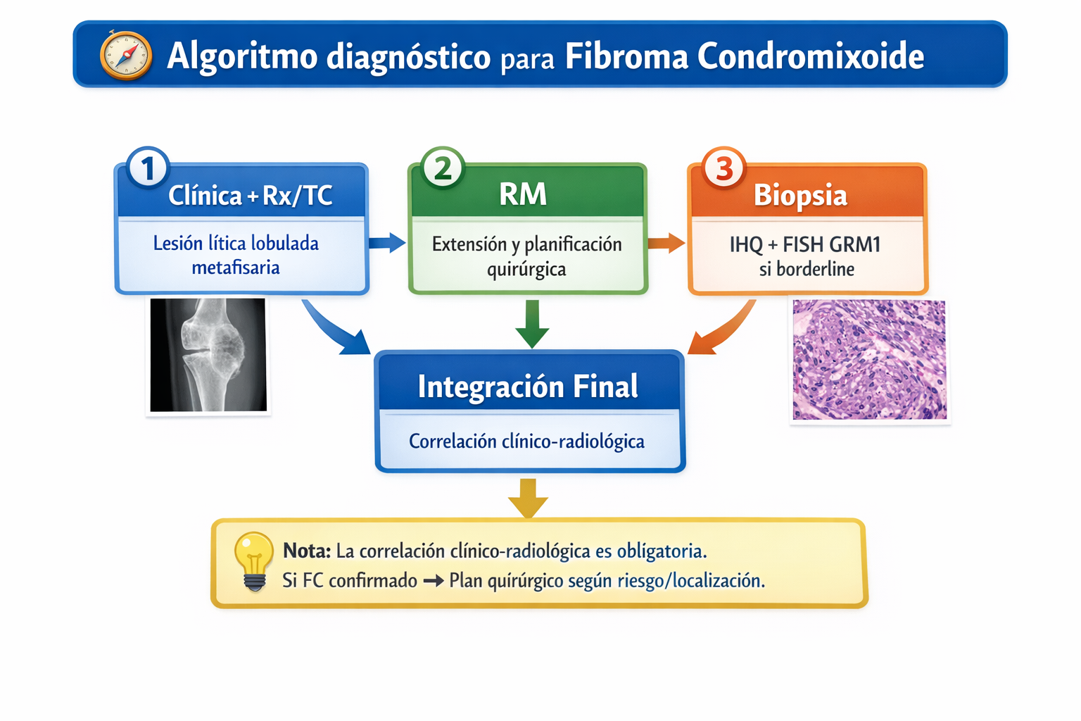 Algoritmo diagnóstico para fibroma condromixoide