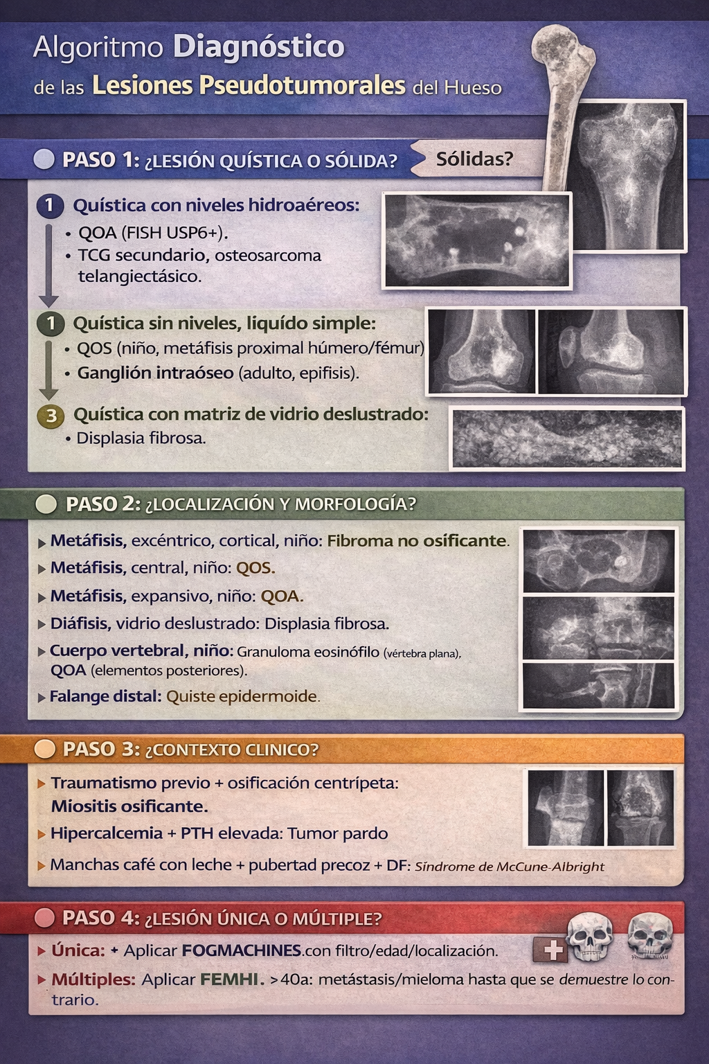 Algoritmo diagnóstico de lesiones pseudotumorales del hueso