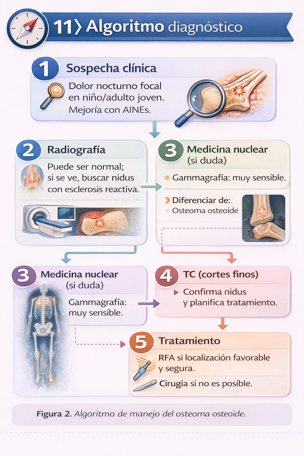 Algoritmo diagnóstico del osteoma osteoide