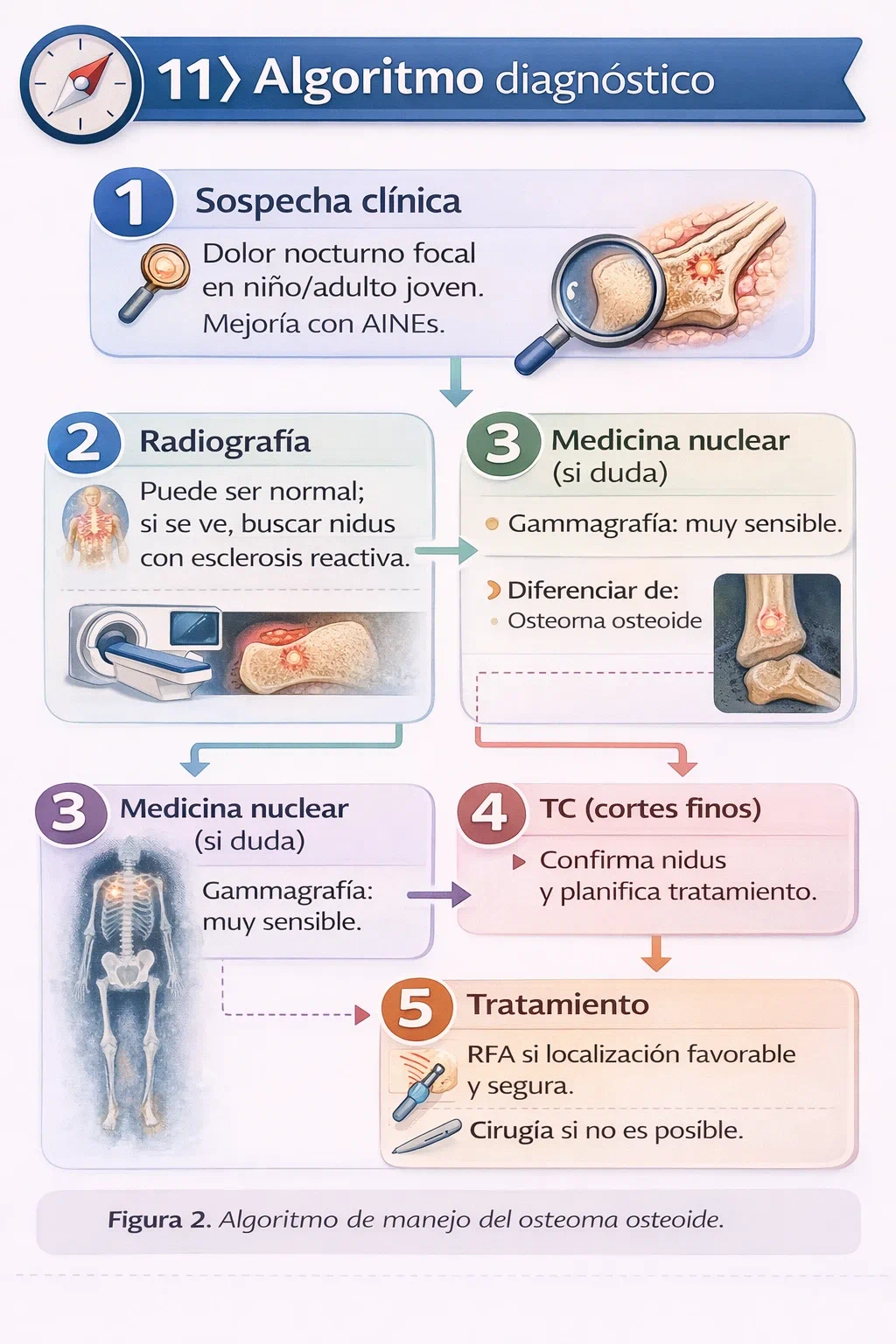 Algoritmo diagnóstico del osteoma osteoide