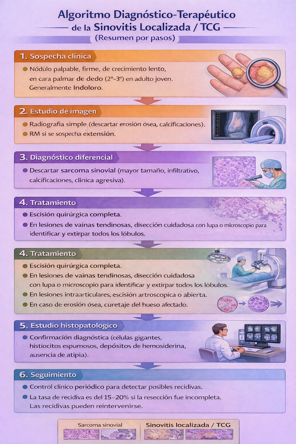 Algoritmo de manejo de la sinovitis vellonodular localizada