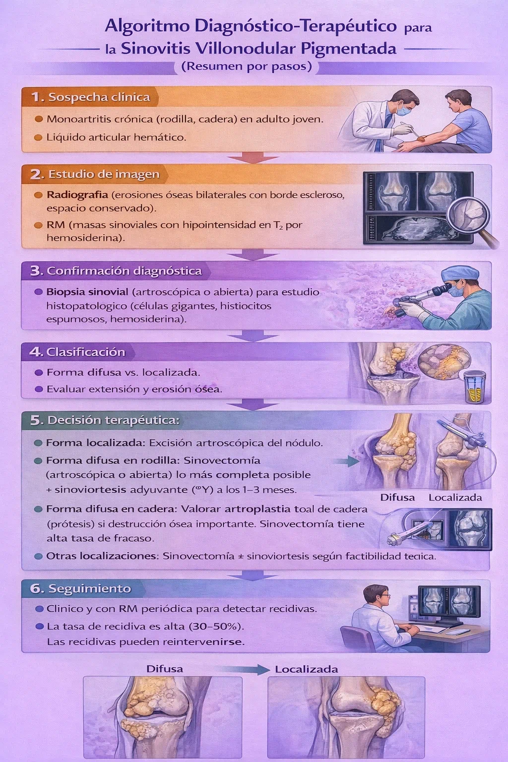 Algoritmo de manejo de la sinovitis vellonodular pigmentada