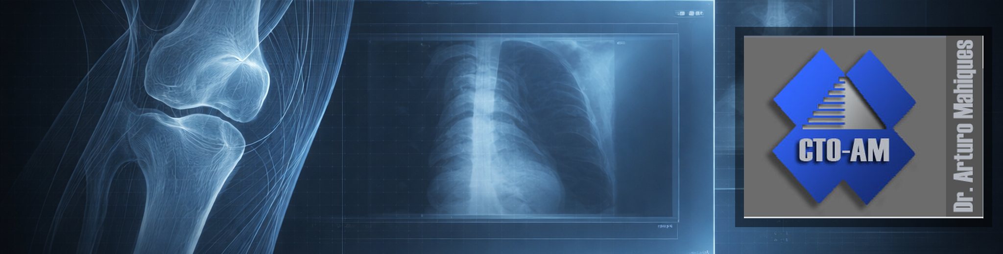 Tumores del aparato locomotor